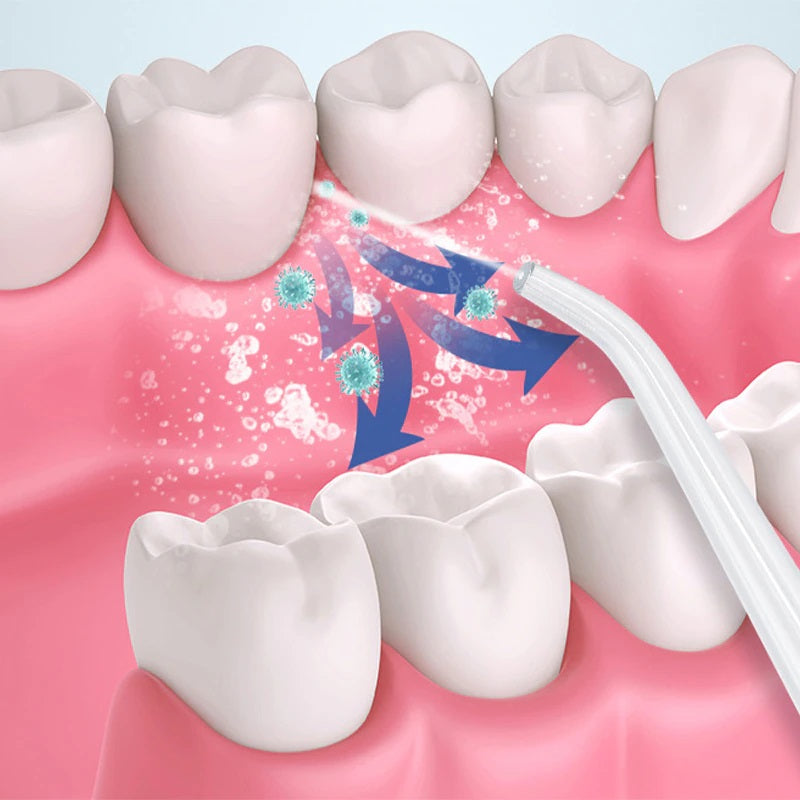 Irigator Bucal Profesional Funcție Masaj – Curățare Avansată pentru o Sănătate Orală Perfectă